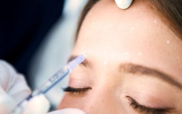 Botox medicina estetica