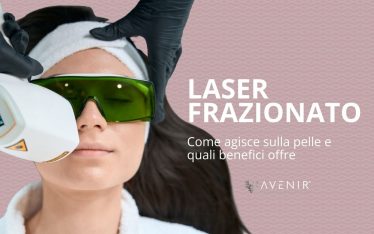 laser frazionato